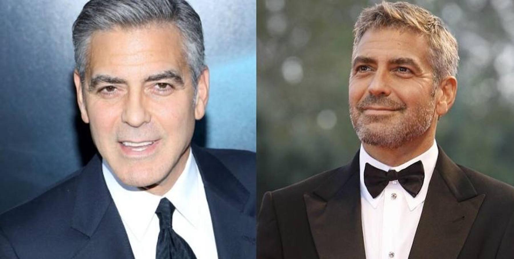 Celebrities transformados por el botox
