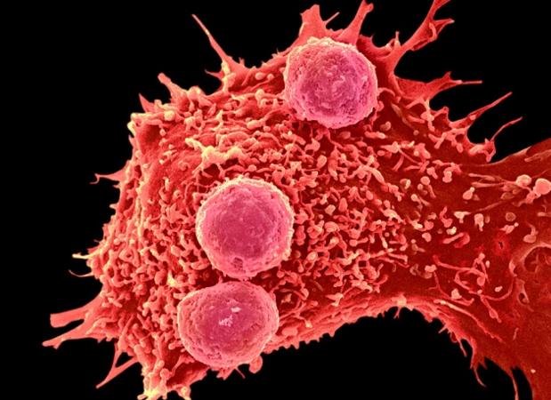 La edición de genes tiene múltiples aplicaciones, pero puede usarse para potenciar el sistema inmune para que luche contra algunos tipos de tumores