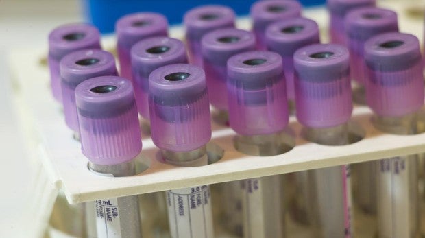 El alzhéimer podría detectarse 20 años antes de los primeros síntomas