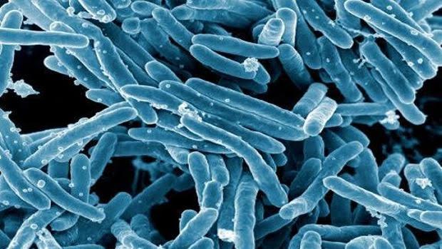 'Mycobacterium tuberculosis'
