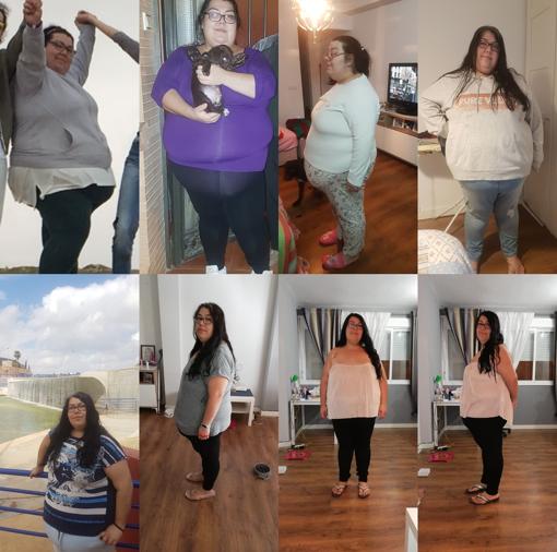 Cintia Dormido pesaba 167 kilos y se operó hace tres meses